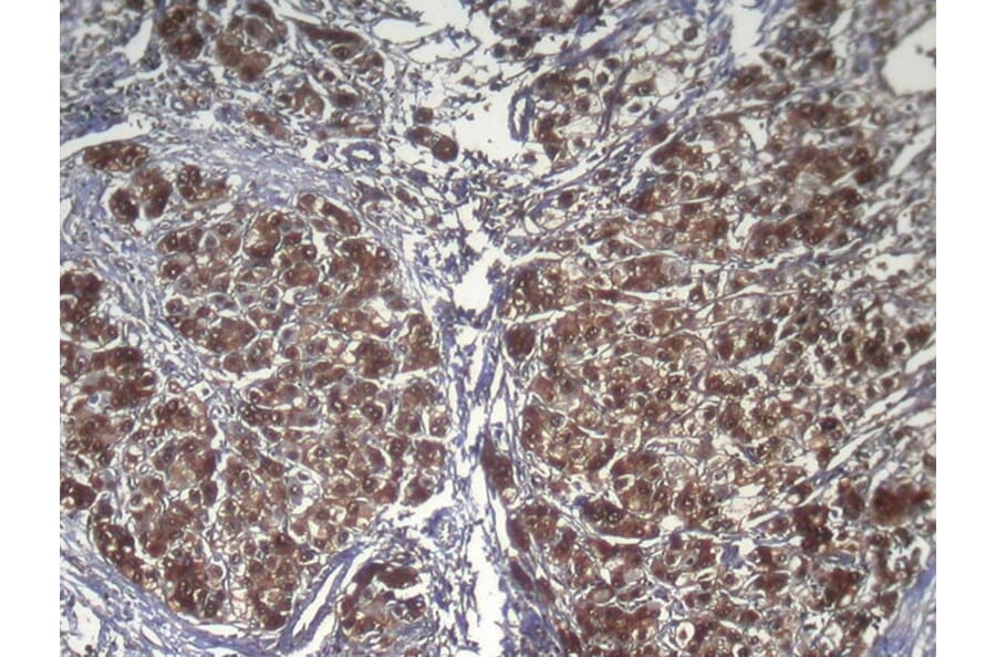 Immunohistochemistry - RPS15 Antibody from Signalway Antibody (42938) - Antibodies.com