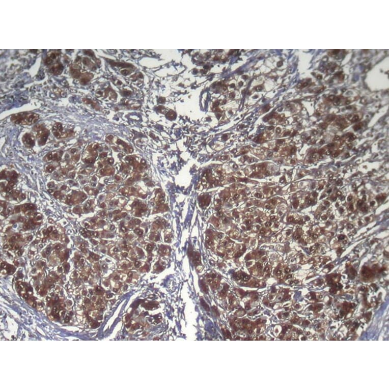 Immunohistochemistry - RPS15 Antibody from Signalway Antibody (42938) - Antibodies.com
