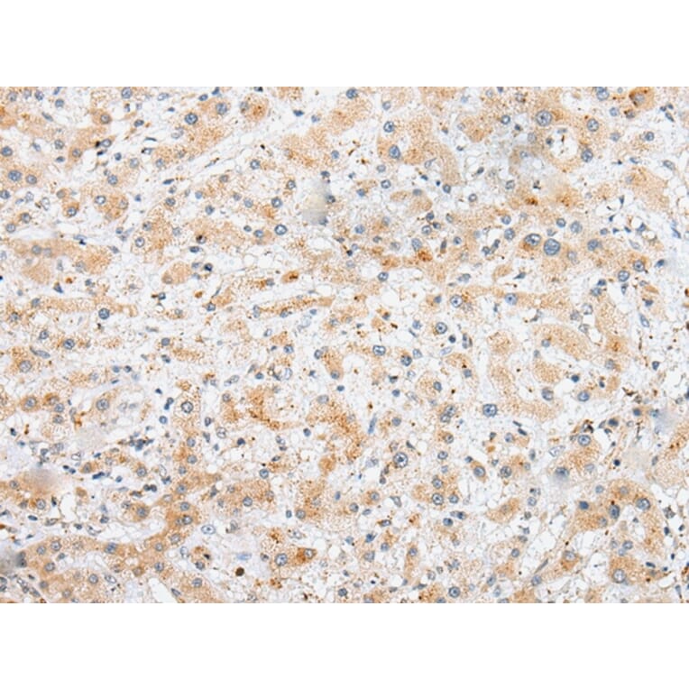 Immunohistochemistry - SYCE3 Antibody from Signalway Antibody (42939) - Antibodies.com