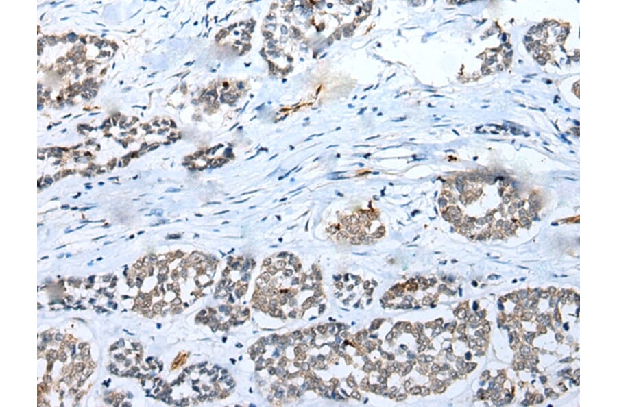 Immunohistochemistry - SYCE3 Antibody from Signalway Antibody (42939) - Antibodies.com