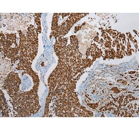 Immunohistochemistry - LSAMP Antibody from Signalway Antibody (42962) - Antibodies.com