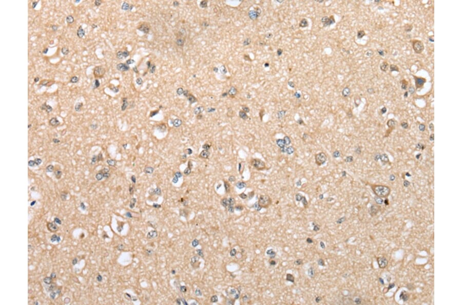 Immunohistochemistry - DYDC2 Antibody from Signalway Antibody (42965) - Antibodies.com