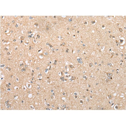 Immunohistochemistry - DYDC2 Antibody from Signalway Antibody (42965) - Antibodies.com