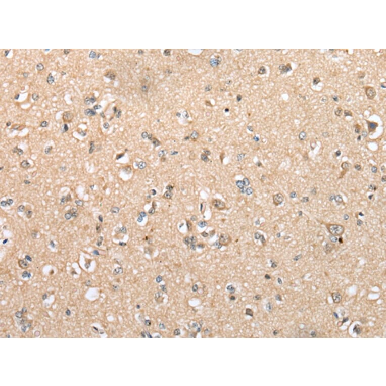 Immunohistochemistry - DYDC2 Antibody from Signalway Antibody (42965) - Antibodies.com