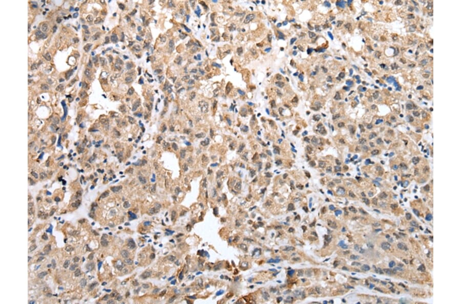 Immunohistochemistry - CSRP3 Antibody from Signalway Antibody (42970) - Antibodies.com