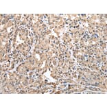 Immunohistochemistry - CSRP3 Antibody from Signalway Antibody (42970) - Antibodies.com