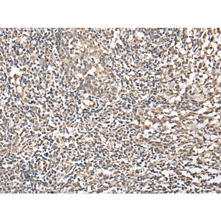 Immunohistochemistry - CSRP3 Antibody from Signalway Antibody (42970) - Antibodies.com