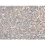 Immunohistochemistry - CSRP3 Antibody from Signalway Antibody (42970) - Antibodies.com