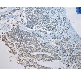 Immunohistochemistry - SETD3 Antibody from Signalway Antibody (42974) - Antibodies.com