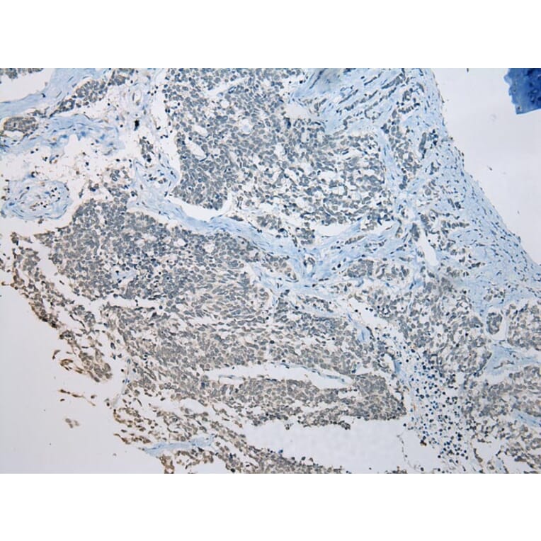 Immunohistochemistry - SETD3 Antibody from Signalway Antibody (42974) - Antibodies.com