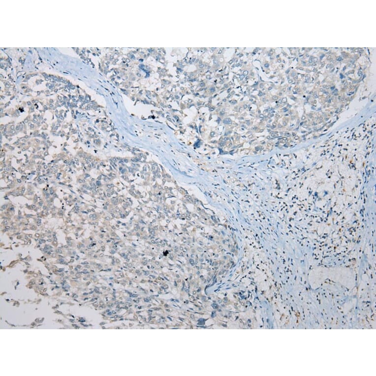 Immunohistochemistry - SETD3 Antibody from Signalway Antibody (42974) - Antibodies.com