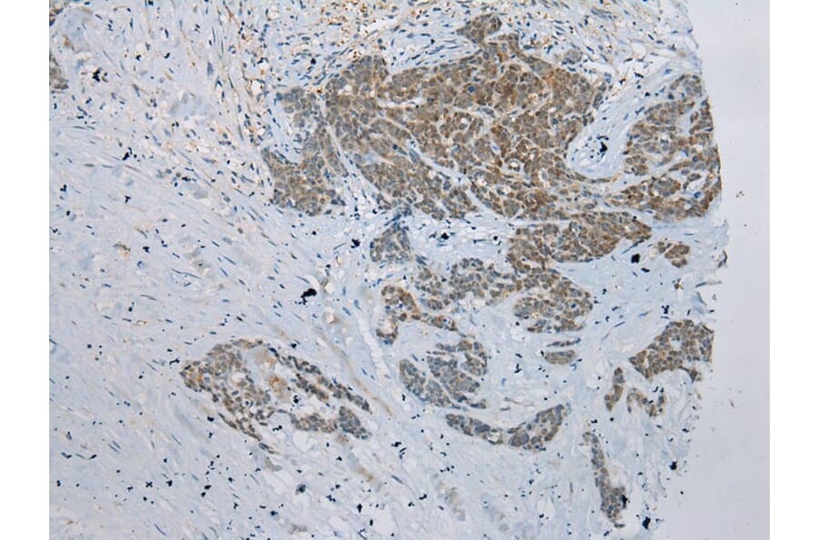 Immunohistochemistry - GSTM4 Antibody from Signalway Antibody (42977) - Antibodies.com