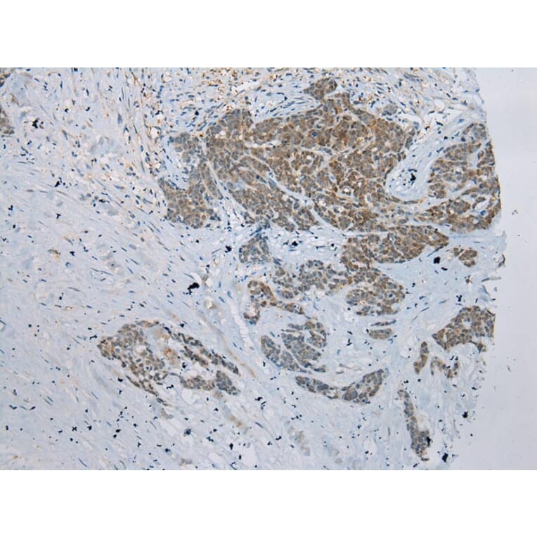 Immunohistochemistry - GSTM4 Antibody from Signalway Antibody (42977) - Antibodies.com