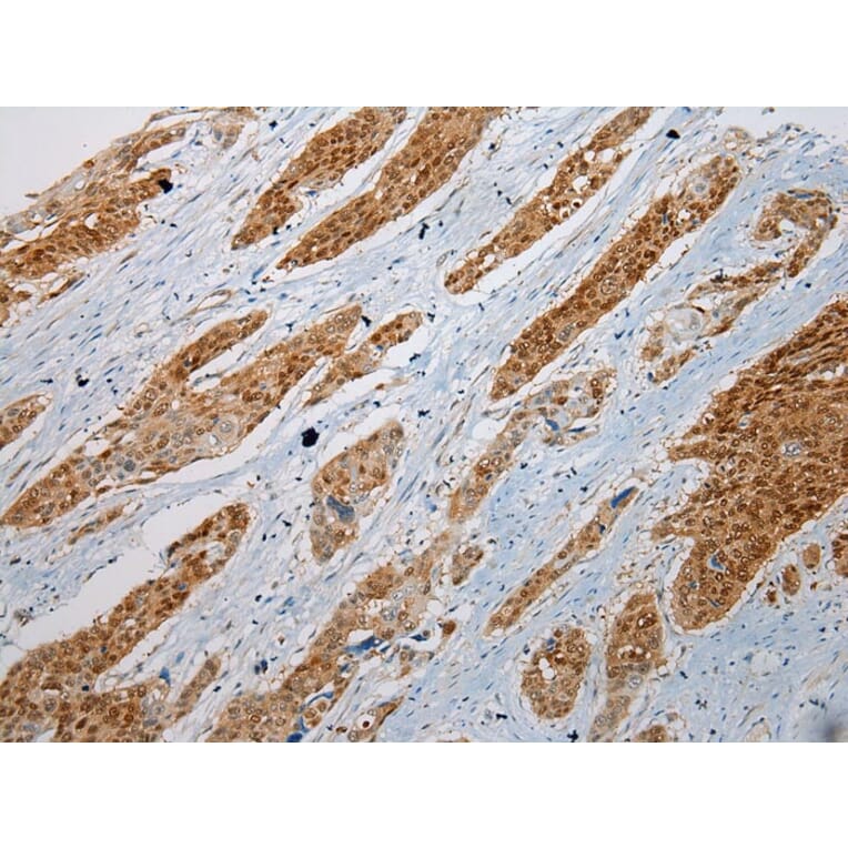 Immunohistochemistry - GSTM4 Antibody from Signalway Antibody (42977) - Antibodies.com