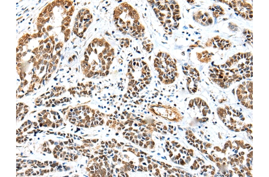 Immunohistochemistry - TWSG1 Antibody from Signalway Antibody (42983) - Antibodies.com
