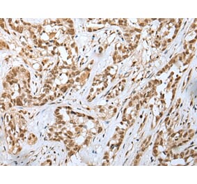 Immunohistochemistry - GINS4 Antibody from Signalway Antibody (42985) - Antibodies.com