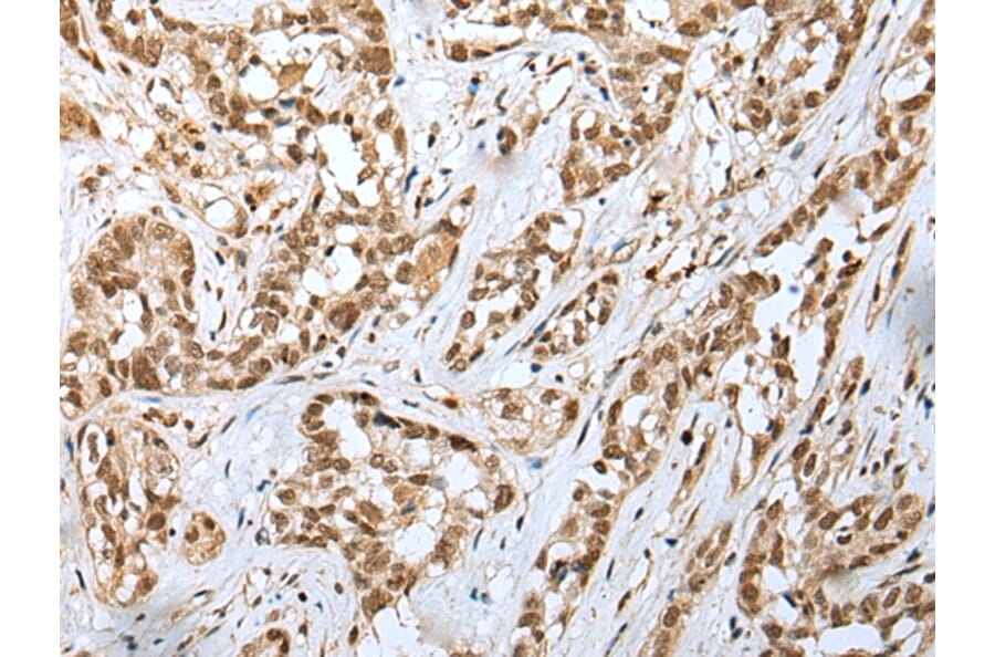 Immunohistochemistry - GINS4 Antibody from Signalway Antibody (42985) - Antibodies.com