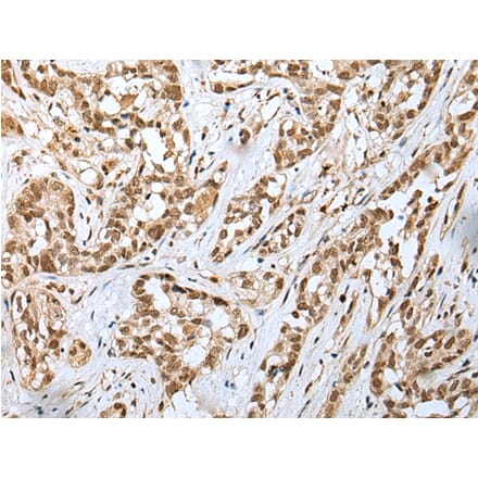 Immunohistochemistry - GINS4 Antibody from Signalway Antibody (42985) - Antibodies.com