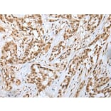 Immunohistochemistry - GINS4 Antibody from Signalway Antibody (42985) - Antibodies.com