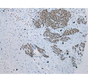 Immunohistochemistry - ZNF22 Antibody from Signalway Antibody (42986) - Antibodies.com