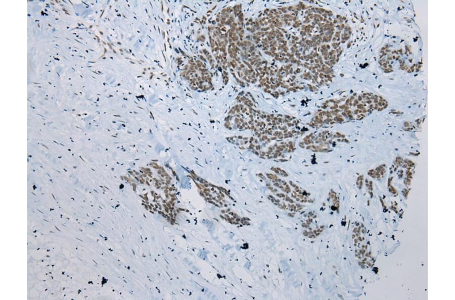 Immunohistochemistry - ZNF22 Antibody from Signalway Antibody (42986) - Antibodies.com