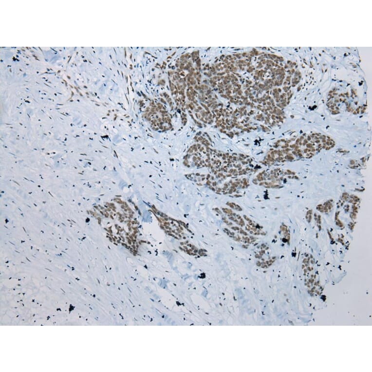Immunohistochemistry - ZNF22 Antibody from Signalway Antibody (42986) - Antibodies.com