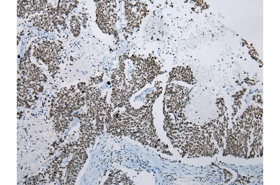 Immunohistochemistry - ZNF22 Antibody from Signalway Antibody (42986) - Antibodies.com