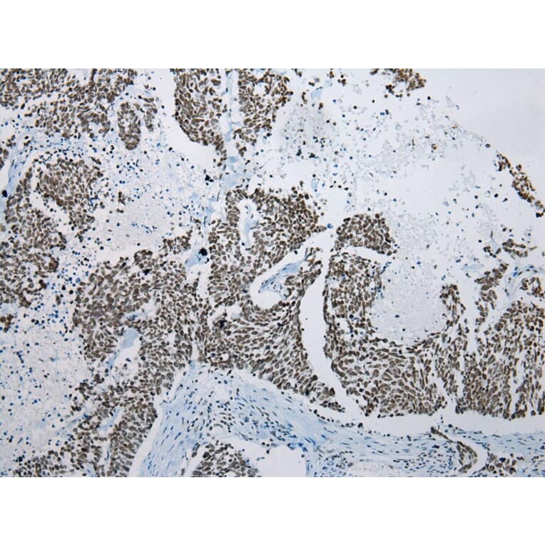 Immunohistochemistry - ZNF22 Antibody from Signalway Antibody (42986) - Antibodies.com