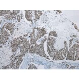 Immunohistochemistry - ZNF22 Antibody from Signalway Antibody (42986) - Antibodies.com