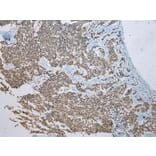 Immunohistochemistry - FAM3D Antibody from Signalway Antibody (42987) - Antibodies.com