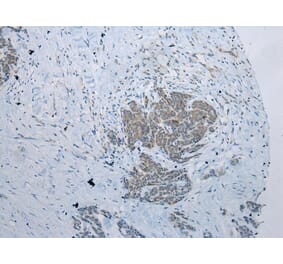 Immunohistochemistry - NAA60 Antibody from Signalway Antibody (42996) - Antibodies.com