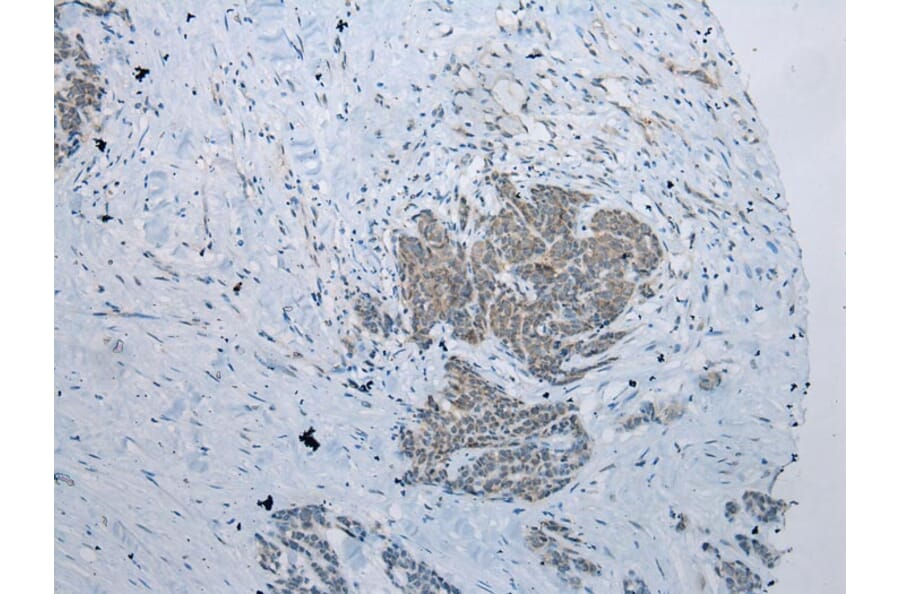 Immunohistochemistry - NAA60 Antibody from Signalway Antibody (42996) - Antibodies.com