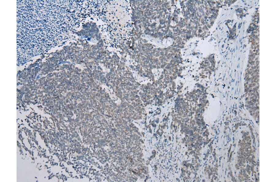 Immunohistochemistry - NAA60 Antibody from Signalway Antibody (42996) - Antibodies.com