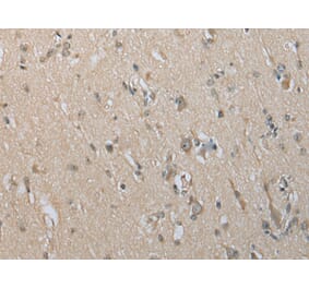 Immunohistochemistry - DECR2 Antibody from Signalway Antibody (42998) - Antibodies.com