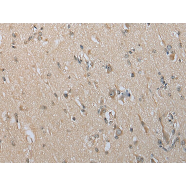 Immunohistochemistry - DECR2 Antibody from Signalway Antibody (42998) - Antibodies.com