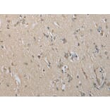 Immunohistochemistry - DECR2 Antibody from Signalway Antibody (42998) - Antibodies.com