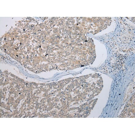 Immunohistochemistry - UBE2Z Antibody from Signalway Antibody (42999) - Antibodies.com