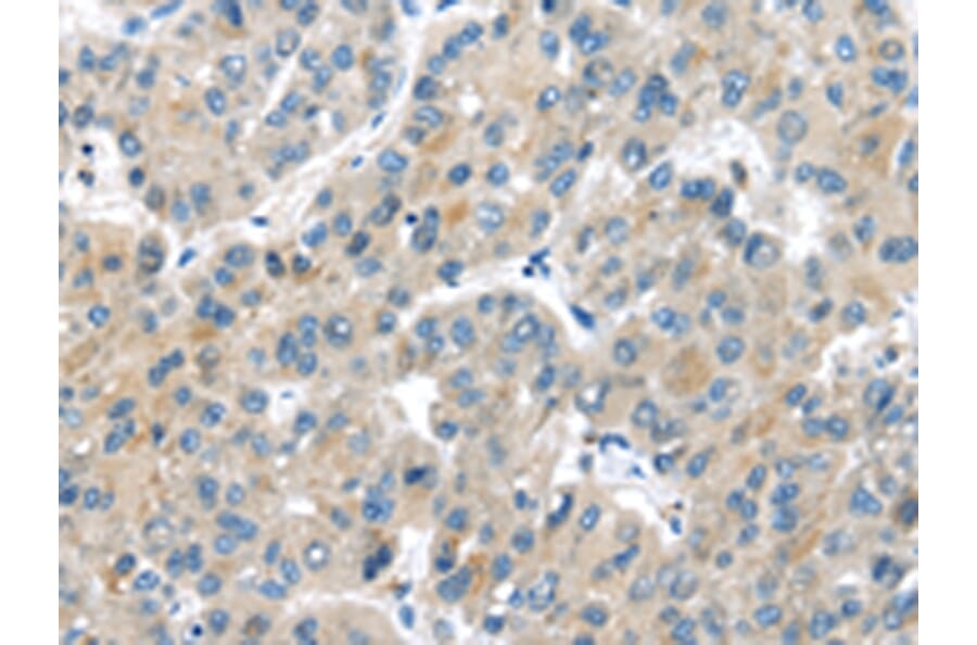 Immunohistochemistry - MASP2 Antibody from Signalway Antibody (43097) - Antibodies.com