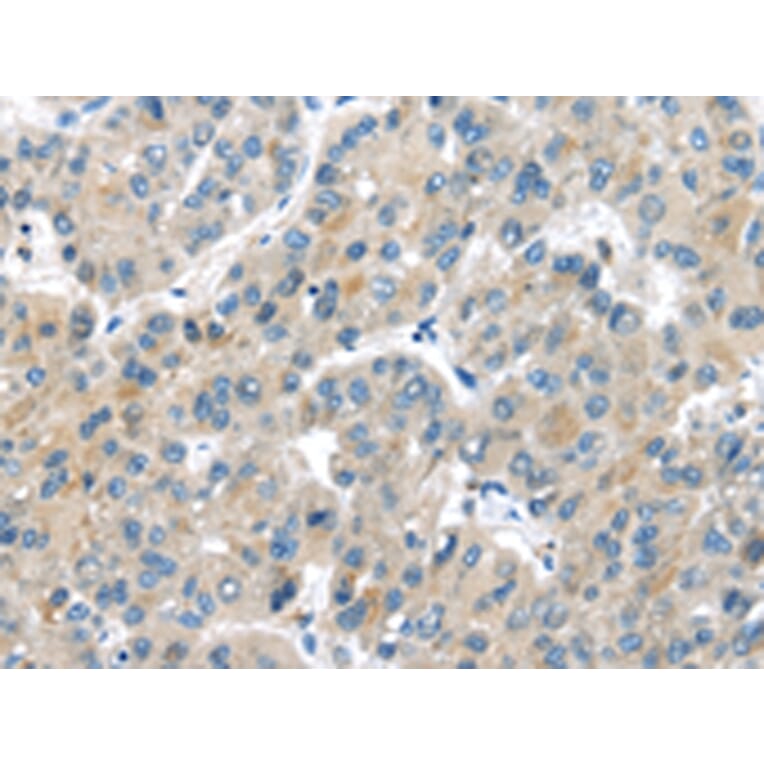 Immunohistochemistry - MASP2 Antibody from Signalway Antibody (43097) - Antibodies.com