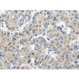 Immunohistochemistry - MASP2 Antibody from Signalway Antibody (43097) - Antibodies.com