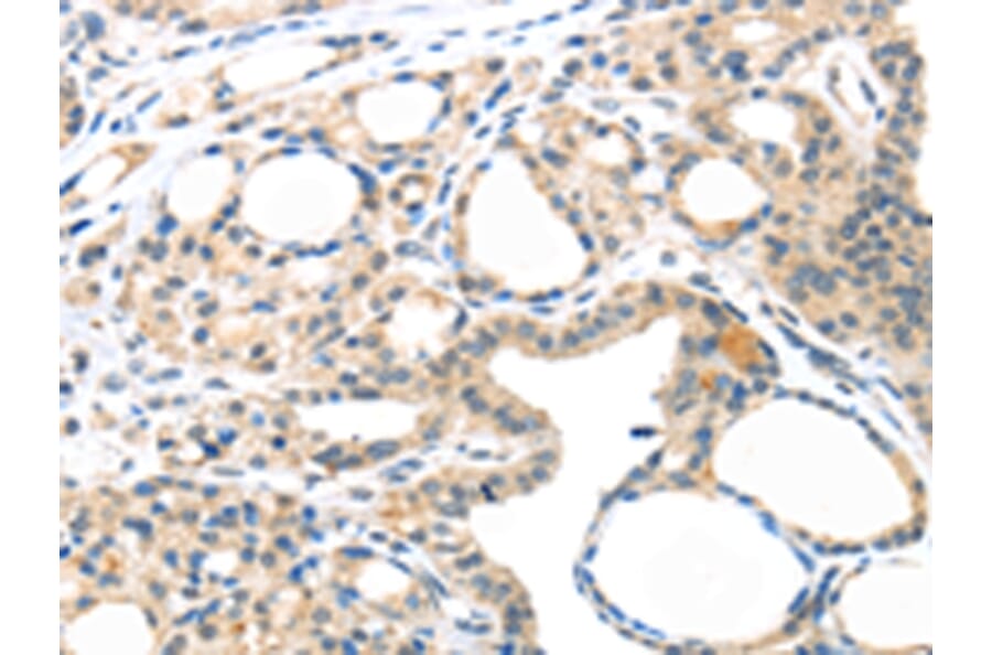 Immunohistochemistry - MASP2 Antibody from Signalway Antibody (43097) - Antibodies.com