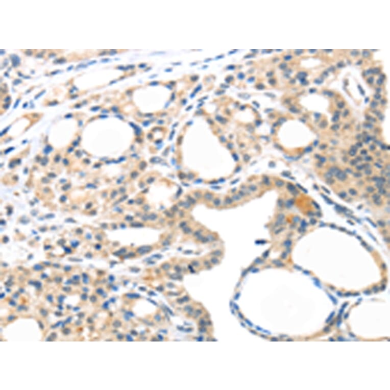 Immunohistochemistry - MASP2 Antibody from Signalway Antibody (43097) - Antibodies.com
