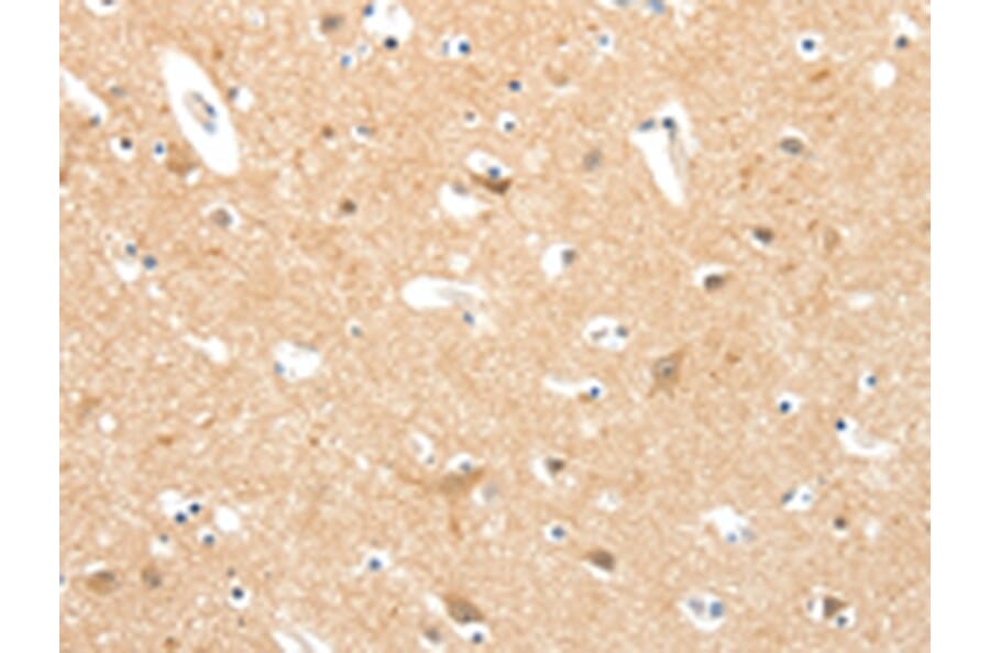 Immunohistochemistry - TIGAR Antibody from Signalway Antibody (43101) - Antibodies.com