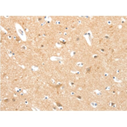 Immunohistochemistry - TIGAR Antibody from Signalway Antibody (43101) - Antibodies.com