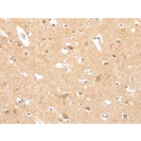 Immunohistochemistry - TIGAR Antibody from Signalway Antibody (43101) - Antibodies.com