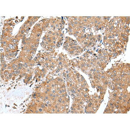 Immunohistochemistry - ACSL3 Antibody from Signalway Antibody (43113) - Antibodies.com