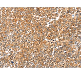 Immunohistochemistry - LOXL2 Antibody from Signalway Antibody (43135) - Antibodies.com