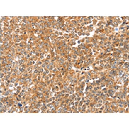 Immunohistochemistry - LOXL2 Antibody from Signalway Antibody (43135) - Antibodies.com