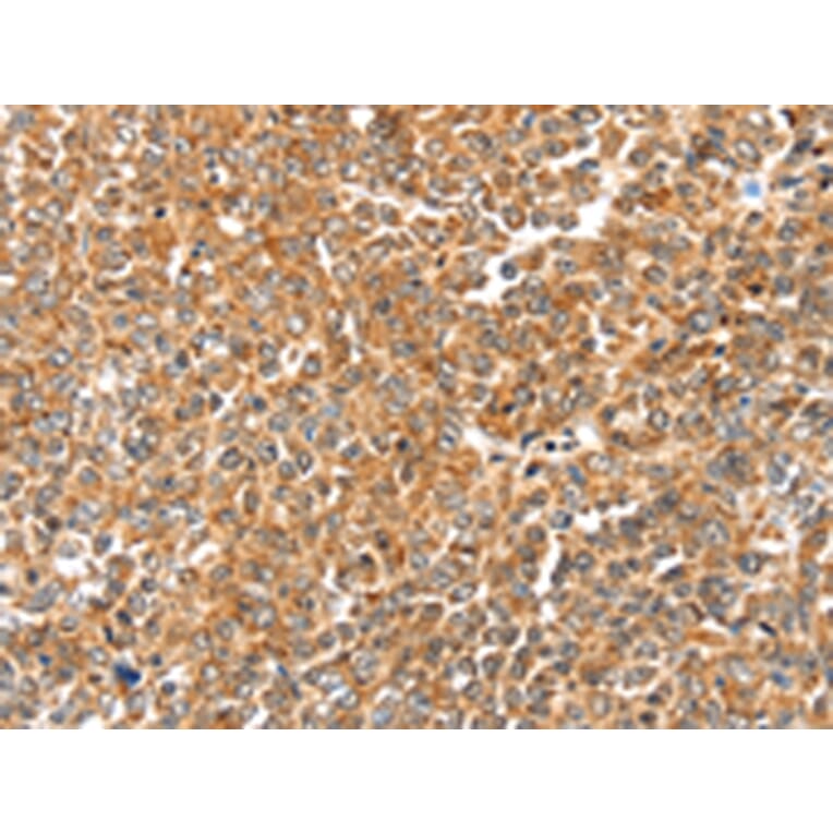 Immunohistochemistry - LOXL2 Antibody from Signalway Antibody (43135) - Antibodies.com