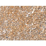 Immunohistochemistry - LOXL2 Antibody from Signalway Antibody (43135) - Antibodies.com